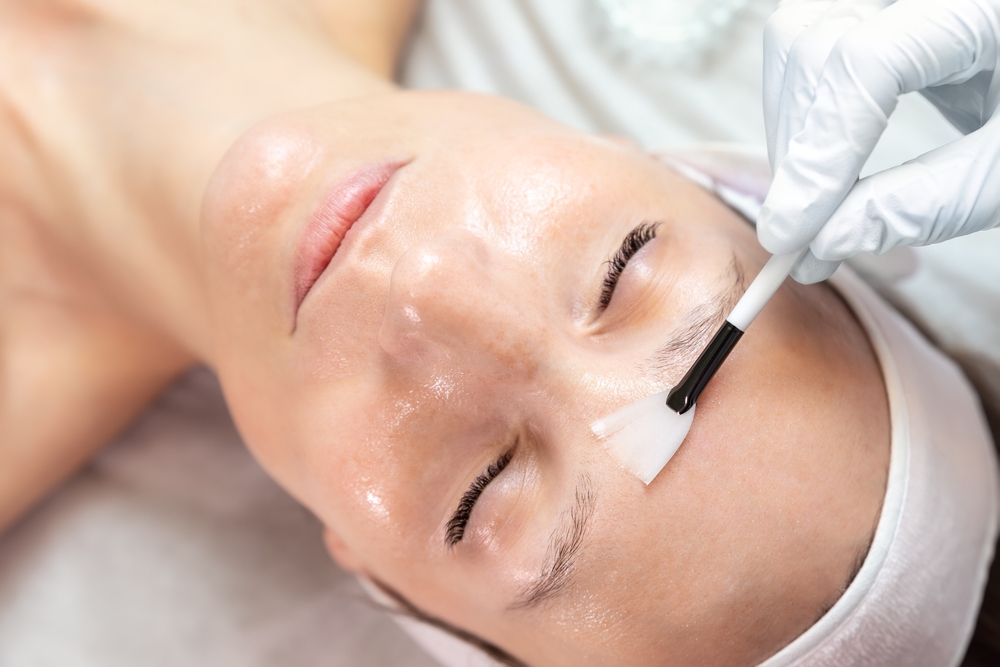 medical grade skin peel ryanrae