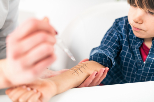 Comprehensive Allergy Evaluation - skin testing in kids
