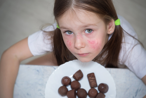 Pediatric Food Allergies - what foods cause allergies in kids