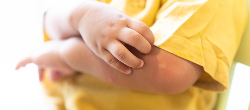 Comprehensive Allergy Evaluation - determining what type of allergies kids have